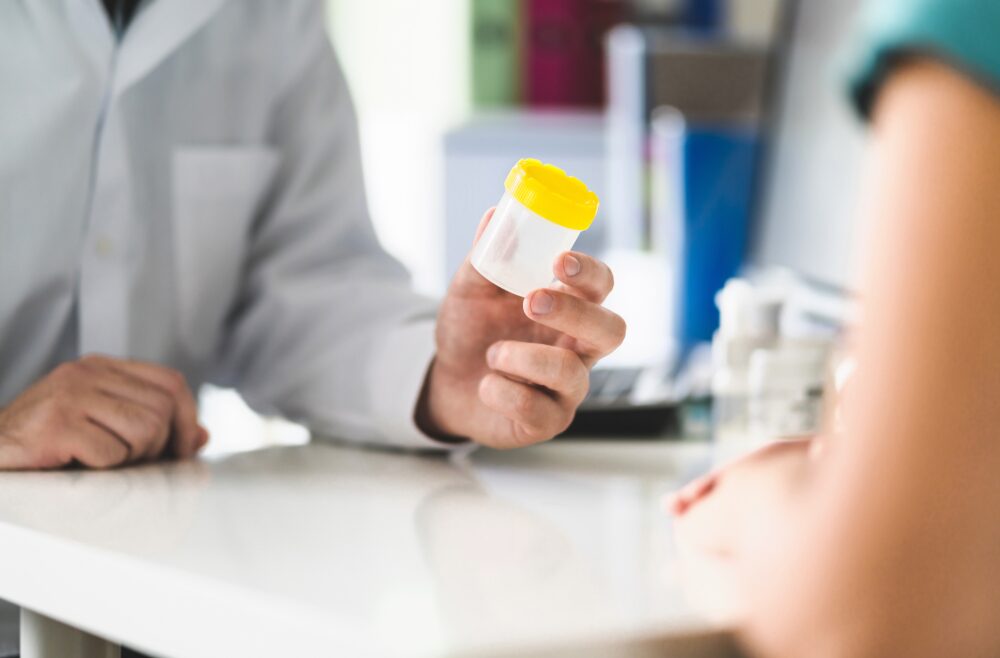Urine Drug Testing (UDT)